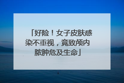 好险！女子皮肤感染不重视，竟致颅内脓肿危及生命